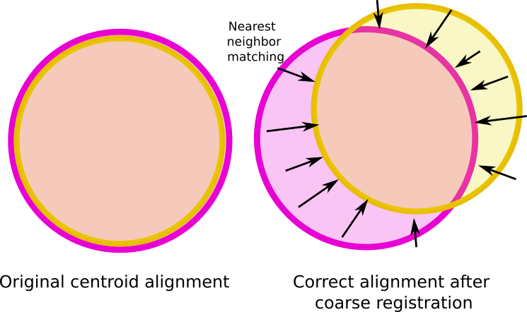 Partial overlap in point clouds is an extra challenge that required a trimmed ICP approach.